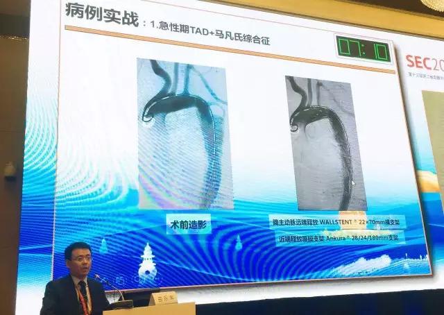 图：曲乐丰教授演讲现场.jpg