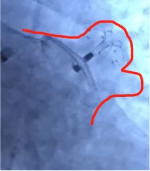 微信图片_20180125145122.jpg 微信图片_20180125145122.jpg