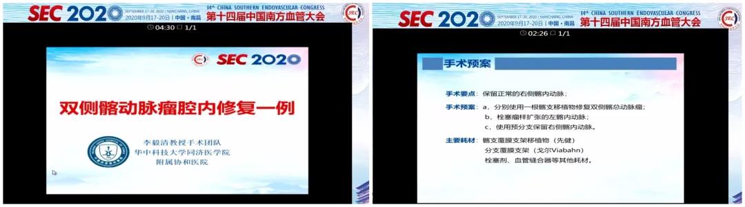 1830dzx628 1830dzx628