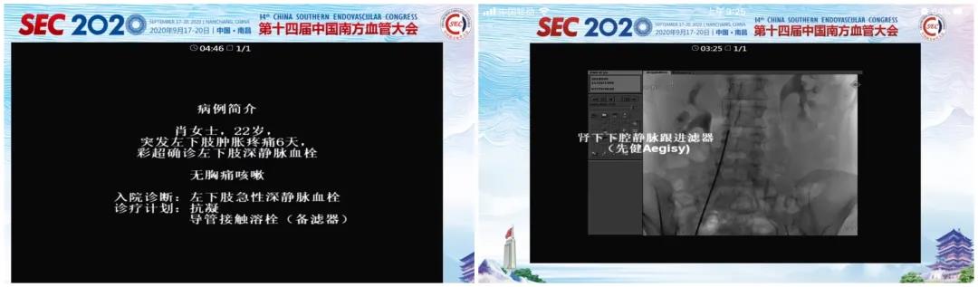 1830x2hrv4 1830x2hrv4
