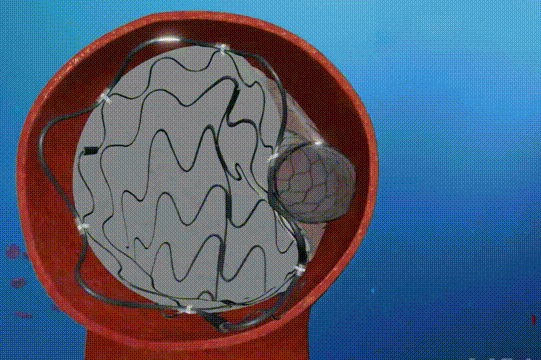640.gif 640.gif